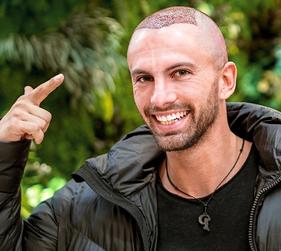 Hair transplant Istanbul with Skilled and Certified Surgeons